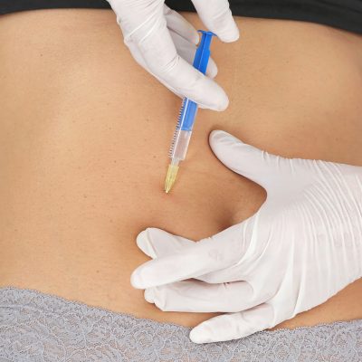 intradermoterapia01